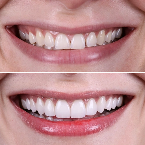 smile1