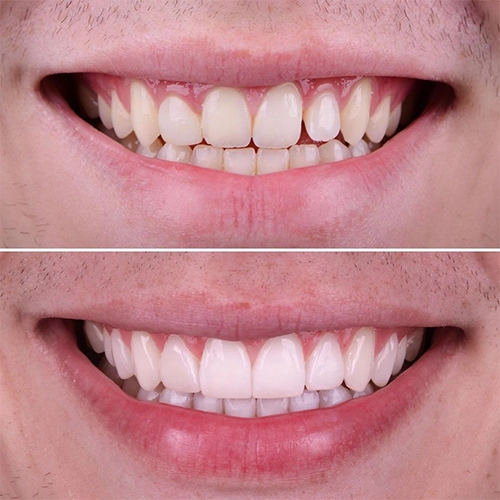 smile2