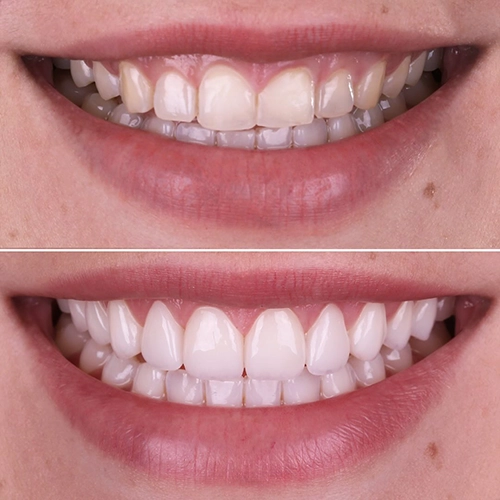 smile3
