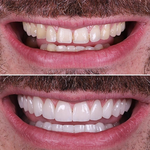 smile4
