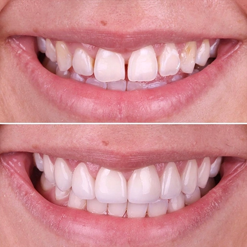 smile5